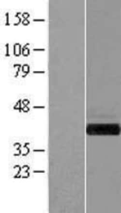 Novus Biologicals&trade;&nbsp;GIPC1 Overexpression Lysate