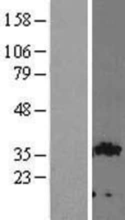Novus Biologicals&trade;&nbsp;GIPC2 Overexpression Lysate