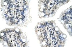 GIPC2 Antibody, Novus Biologicals 0.1mg; Unlabeled:Antibodies, Polyclonal