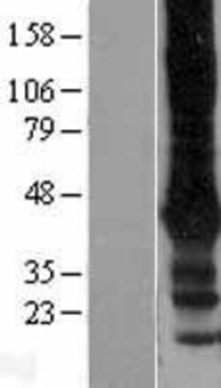 Novus Biologicals™ GIRK2 Overexpression Lysate