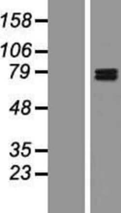 Novus Biologicals&trade;&nbsp;GIT1 Overexpression Lysate
