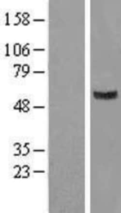 Novus Biologicals&trade;&nbsp;GIT2 Overexpression Lysate