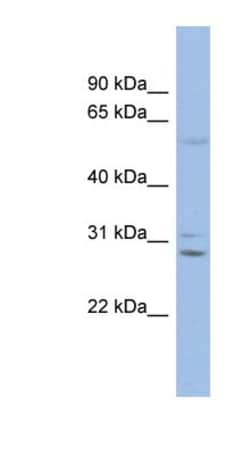 Connexin 30/GJB6 Antibody, Novus Biologicals:Antibodies:Primary Antibodies
