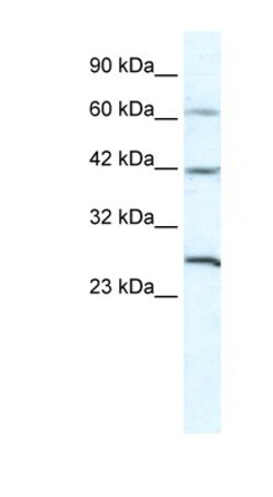 GJD3 Antibody, Novus Biologicals 100&mu;L; Unlabeled:Antibodies, Polyclonal