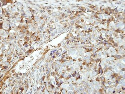 GK5 Antibody, Novus Biologicals 0.1mL; Unlabeled:Antibodies, Polyclonal