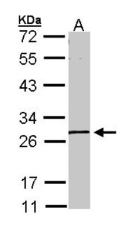 GK5 Antibody, Novus Biologicals 0.1mL; Unlabeled:Antibodies, Polyclonal