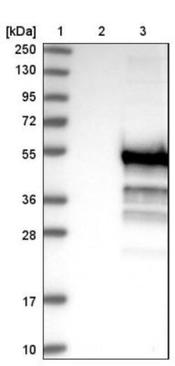 GKAP1 Antibody, Novus Biologicals 0.1mL; Unlabeled:Antibodies, Polyclonal