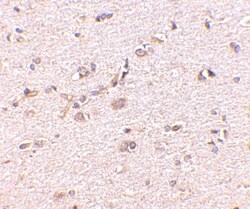 GKAP/DLGAP1 Antibody - BSA Free, Novus Biologicals 0.1mg; Unlabeled:Antibodies,