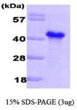 Novus Biologicals&trade;&nbsp;Recombinant Saccharomyces cerevisiae GLC8 His Protein