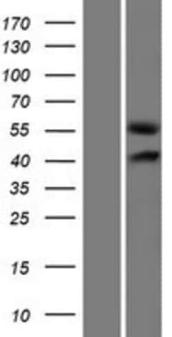 Novus Biologicals™ GLCCl1 Overexpression Lysate