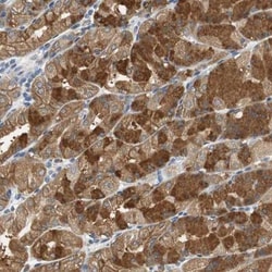 GLCCl1 Antibody, Novus Biologicals:Antibodies:Primary Antibodies