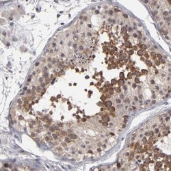 GLCCl1 Antibody, Novus Biologicals 0.1mL; Unlabeled:Antibodies, Polyclonal