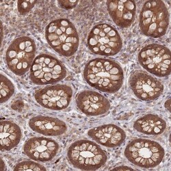 GLE1 Antibody, Novus Biologicals 25 &mu;L; Unlabeled:Antibodies, Polyclonal