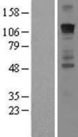 Novus Biologicals&trade;&nbsp;GLI-1 Overexpression Lysate