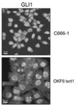 GLI-1 Antibody, Novus Biologicals 0.025mg; Unlabeled:Antibodies, Polyclonal