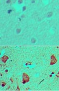 GLI-1 Antibody, Novus Biologicals 0.025mg; Unlabeled:Antibodies, Polyclonal