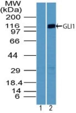 GLI-1 Antibody, Novus Biologicals 0.025mg; Unlabeled:Antibodies, Polyclonal