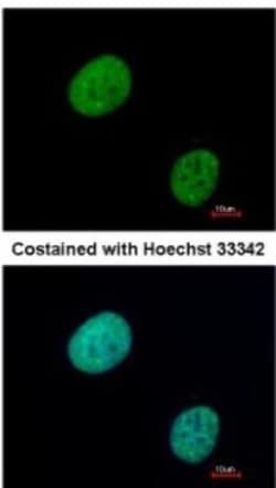 GLI-3 Antibody, Novus Biologicals 0.1mL; Unlabeled:Antibodies, Polyclonal