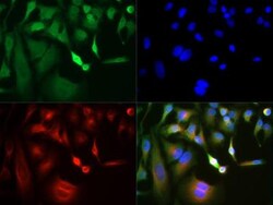 GLI-3 Antibody - BSA Free, Novus Biologicals 0.1mg; Unlabeled:Antibodies,