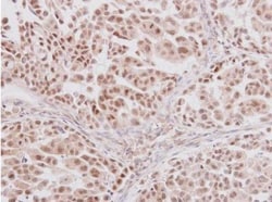 GLI-3 Antibody, Novus Biologicals 0.1mL; Unlabeled:Antibodies, Polyclonal