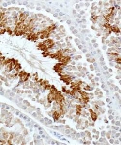 GLI-3 Antibody - BSA Free, Novus Biologicals 0.1mg; Unlabeled:Antibodies,