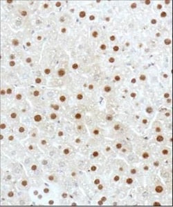 GLI-3 Antibody - BSA Free, Novus Biologicals 0.1mg; Unlabeled:Antibodies,