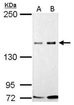 GLI-3 Antibody, Novus Biologicals 0.1mL; Unlabeled:Antibodies, Polyclonal
