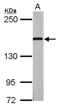 GLI-3 Antibody, Novus Biologicals 0.1mL; Unlabeled:Antibodies, Polyclonal