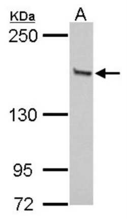 GLI-3 Antibody, Novus Biologicals 0.1mL; Unlabeled:Antibodies, Polyclonal
