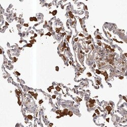 GLIPR2 Antibody, Novus Biologicals 0.1mL; Unlabeled:Antibodies, Polyclonal