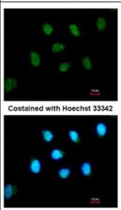 Glis1 Antibody, Novus Biologicals 0.1mL; Unlabeled:Antibodies, Polyclonal