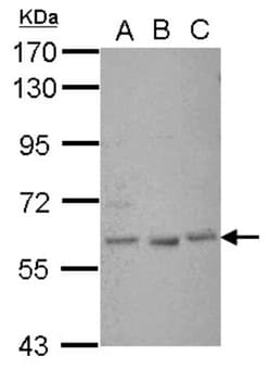 Glis1 Antibody, Novus Biologicals 0.1mL; Unlabeled:Antibodies, Polyclonal