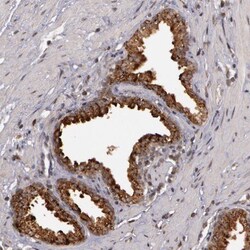 Glis1 Antibody, Novus Biologicals 0.1mL; Unlabeled:Antibodies, Polyclonal