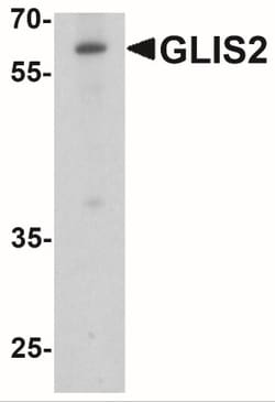 GliS2 Antibody - BSA Free, Novus Biologicals 0.025 mg, Unlabeled:Antibodies,