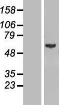 Novus Biologicals&trade;&nbsp;GLMN Overexpression Lysate