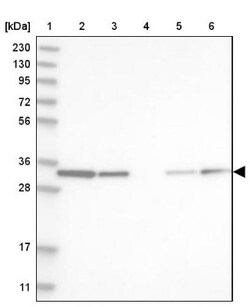 GLOD4 Antibody, Novus Biologicals 0.1mL; Unlabeled:Antibodies, Polyclonal