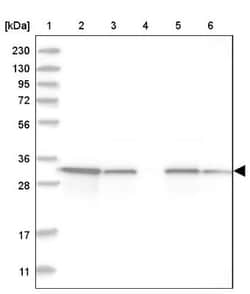 GLOD4 Antibody, Novus Biologicals 25 &mu;L | Buy Online | Novus Biologicals | Fisher Scientific