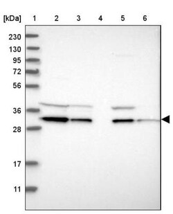 GLOD4 Antibody, Novus Biologicals 0.1mL; Unlabeled:Antibodies, Polyclonal