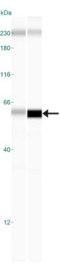 GLP-1R Antibody - BSA Free, Novus Biologicals 0.025mL; Unlabeled:Antibodies,