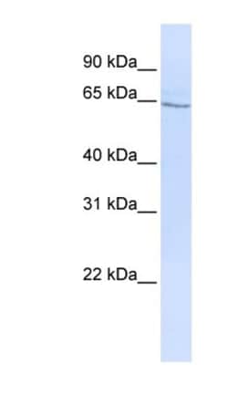 GLP-2R Antibody, Novus Biologicals:Antibodies:Primary Antibodies