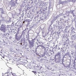 GLP-2R Antibody, Novus Biologicals:Antibodies:Primary Antibodies