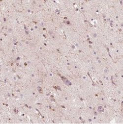 GLRB Antibody, Novus Biologicals 25 &mu;L | Buy Online | Novus Biologicals | Fisher Scientific