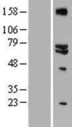 Novus Biologicals&trade;&nbsp;GLS2 Overexpression Lysate