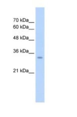 GLS2 Antibody, Novus Biologicals 100 ul; Unconjugated:Antibodies, Polyclonal