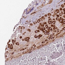 GLT25D1 Antibody, Novus Biologicals:Antibodies:Primary Antibodies