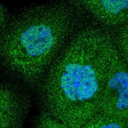 GLT25D2 Antibody, Novus Biologicals 25 &mu;L, Unconjugated:Antibodies,