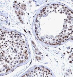 GLT6D1 Antibody, Novus Biologicals 25 &mu;L; Unlabeled:Antibodies, Polyclonal