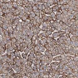 GLT8D2 Antibody, Novus Biologicals 25 &mu;L; Unlabeled:Antibodies, Polyclonal