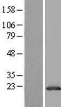 Novus Biologicals&trade;&nbsp;GLTP Overexpression Lysate