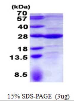 Novus Biologicals&trade;&nbsp;Recombinant Human GLTP His Protein